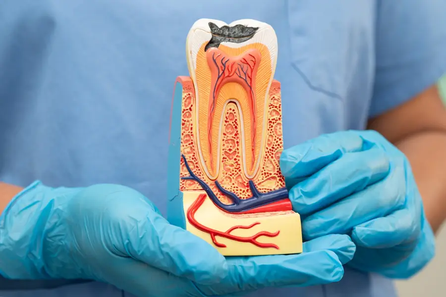 Modelo anatômico de um dente em corte, mostrando a estrutura interna tratada no canal.