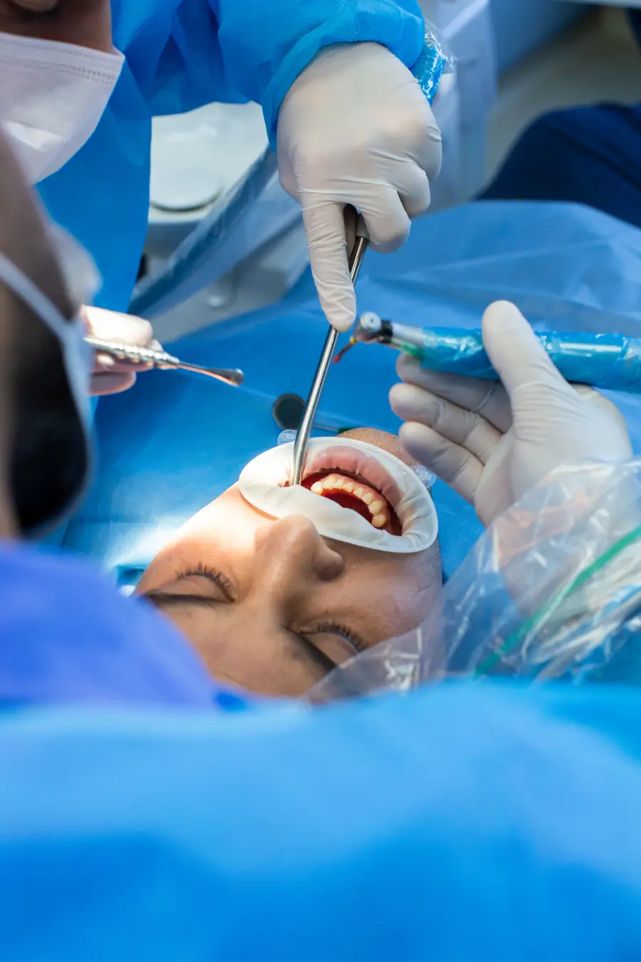 Procedimento odontológico em andamento, com isolamento absoluto do dente tratado.