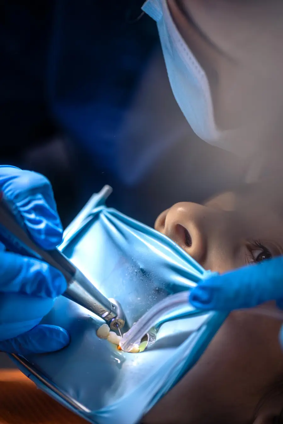 Equipe odontológica realizando um procedimento de tratamento de canal.
