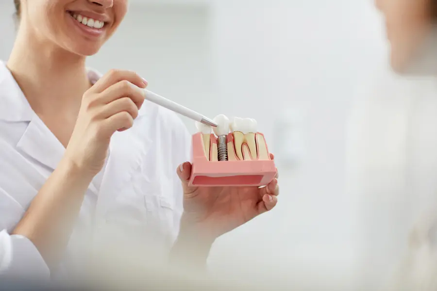 Modelo didático usado para explicar o procedimento de implante dentário.