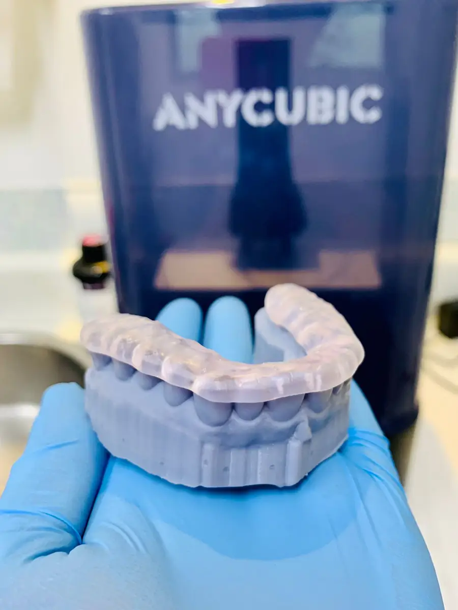 Modelo dentário impresso em impressora 3D, usado no planejamento de tratamento.