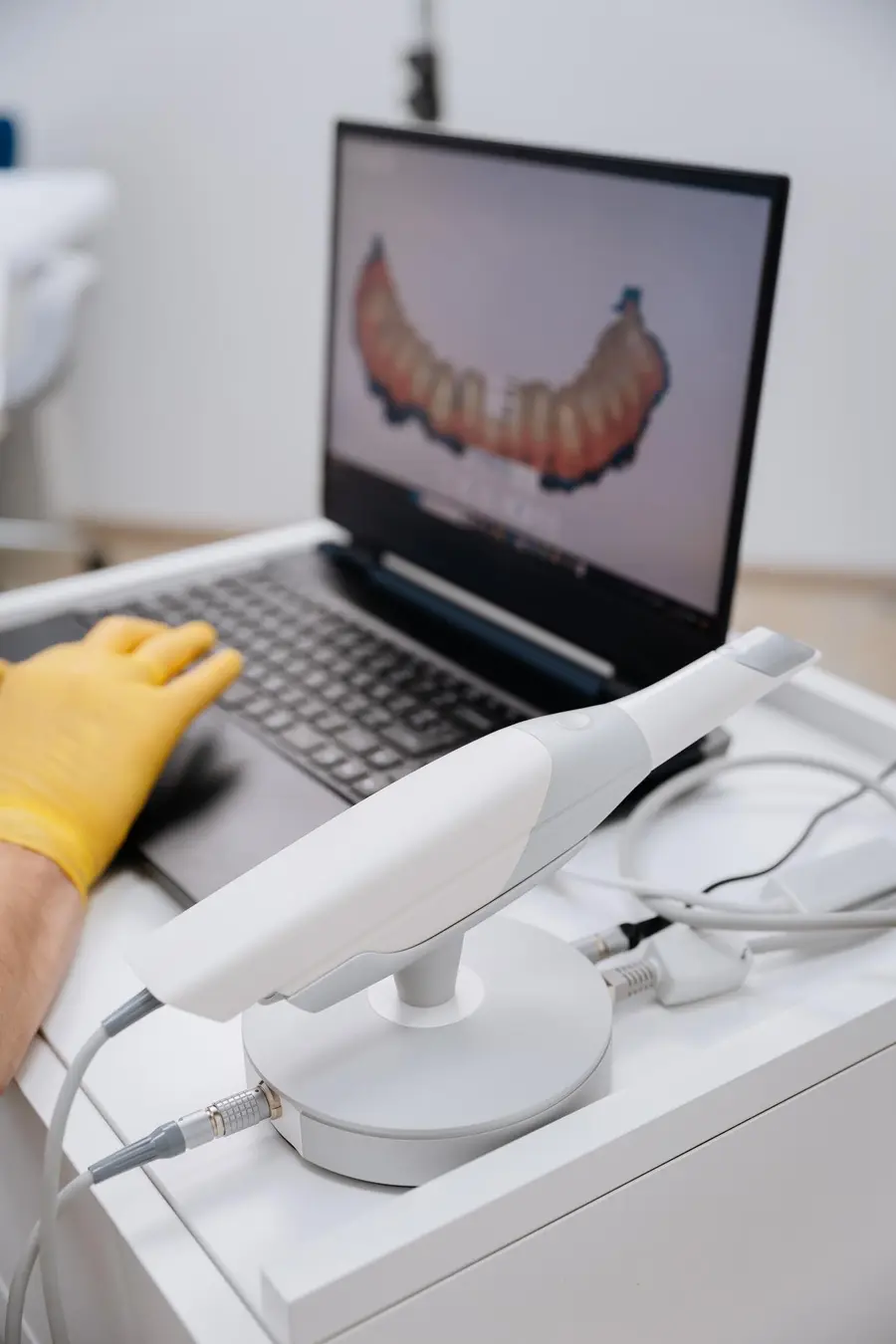Profissional utilizando scanner intraoral durante atendimento odontológico.