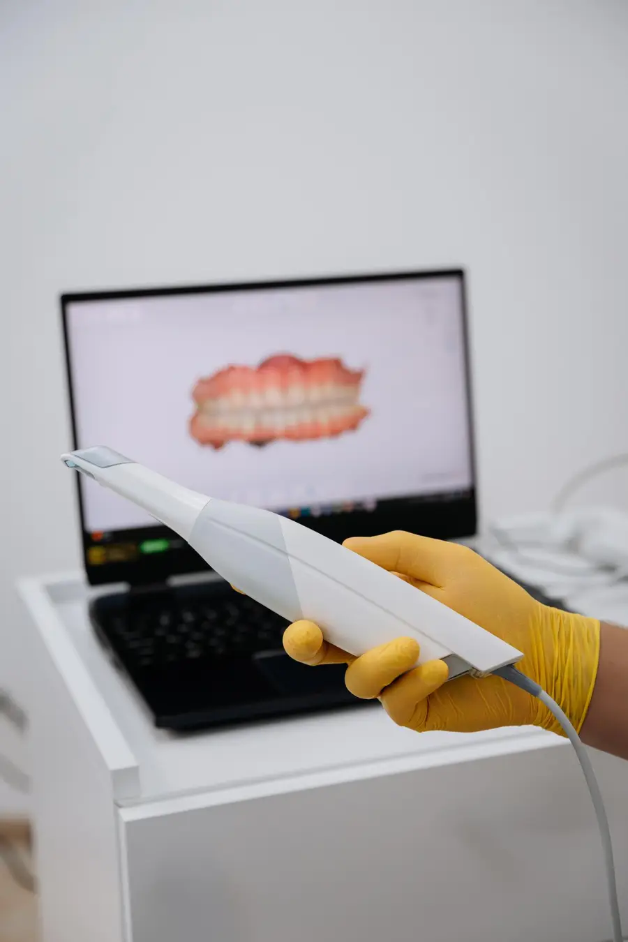 Scanner intraoral e notebook usados durante avaliação odontológica digital.